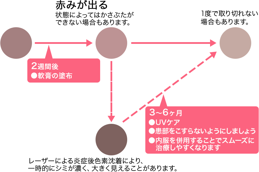 シミの経過