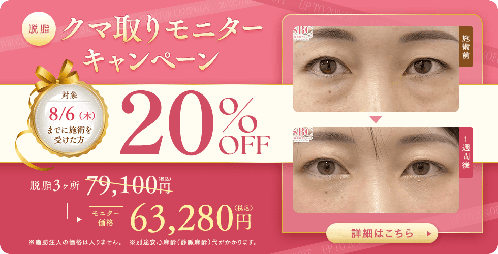 目の下の切らないクマ取り・たるみ(ふくらみ)取り キャンペーン