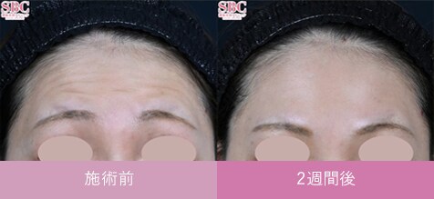 症例写真1