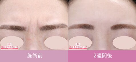症例写真2