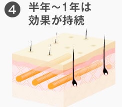 半年～1年は効果が持続