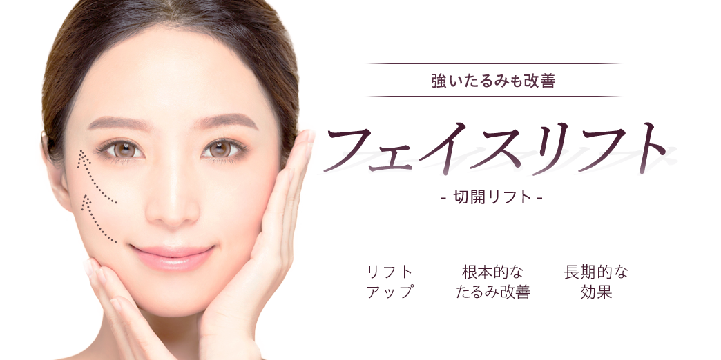 強いたるみも改善フェイスリフト（切開リフト）