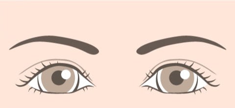余剰皮膚を除去してたるみを改善