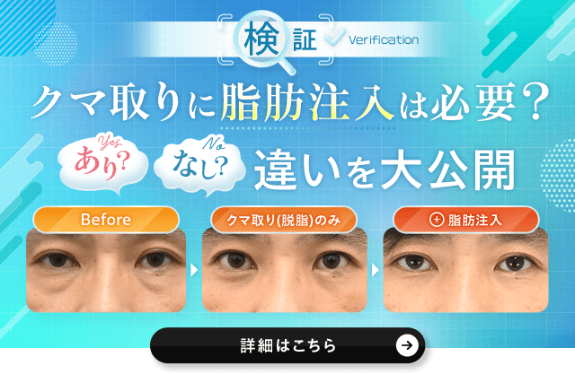 クマ取り＋脂肪注入をしなかった場合