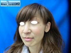 症例写真