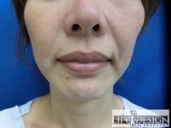 症例写真