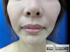 症例写真