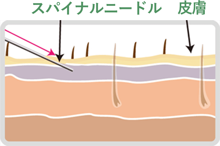 STEP01