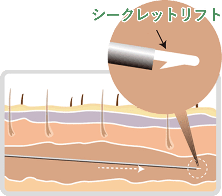 STEP02