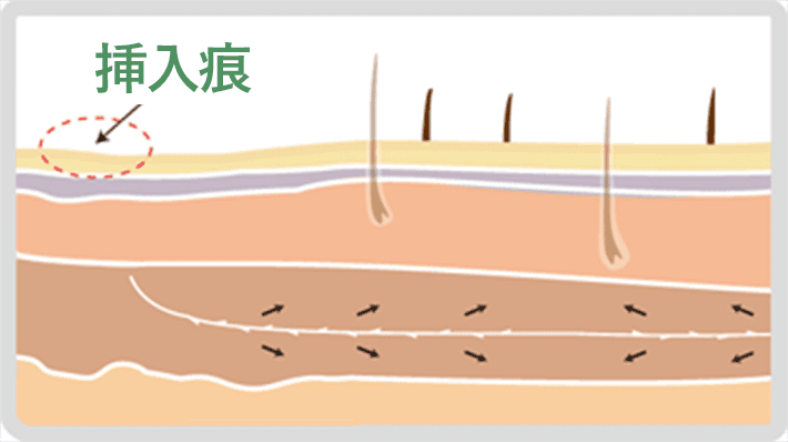 STEP06