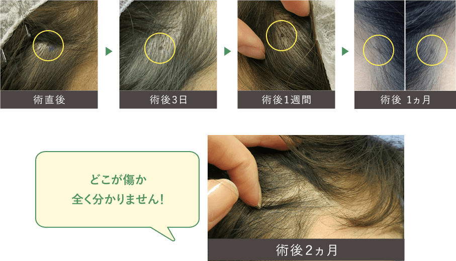 どこが傷か全く分かりません！