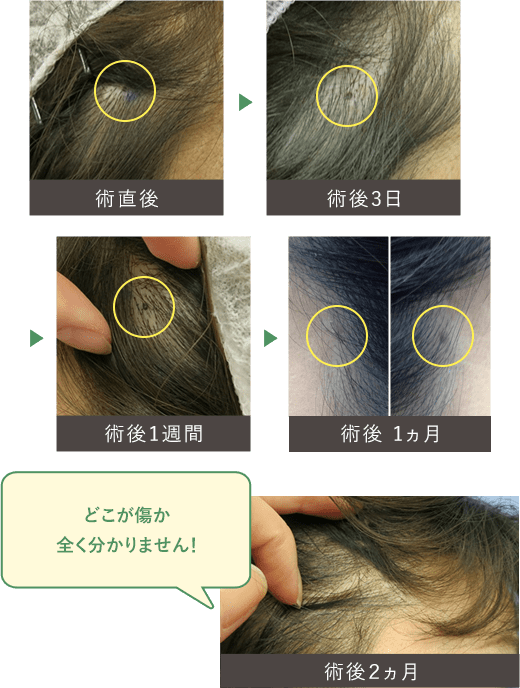 どこが傷か全く分かりません！
