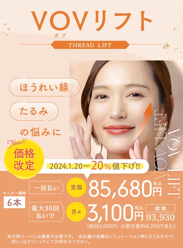 SBC VOVリフト