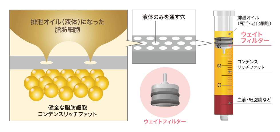 ウェイトフィルター