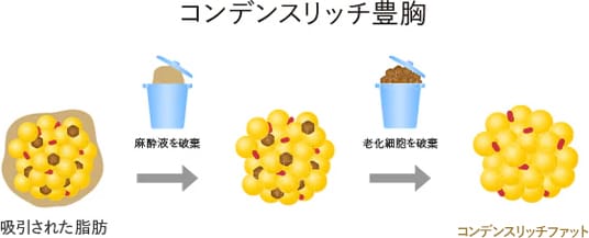 4倍以上の幹細胞群注入で、定着率が高い!イメージ2