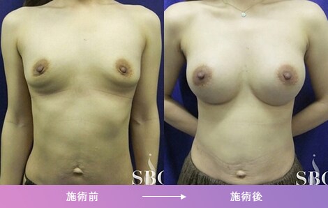 症例写真1