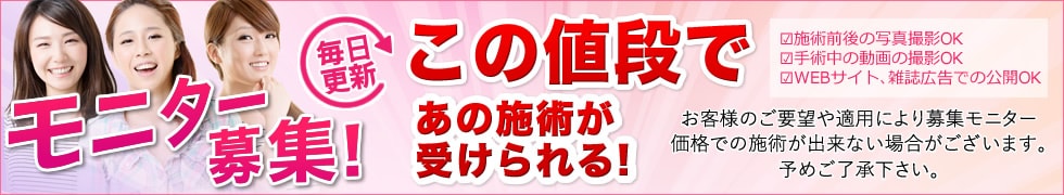施術別モニター募集