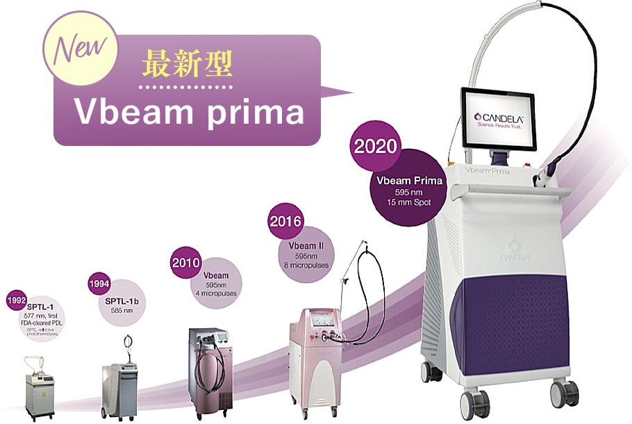Vbeam（Vビーム）最新機種