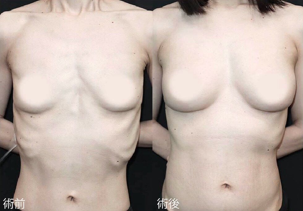 症例