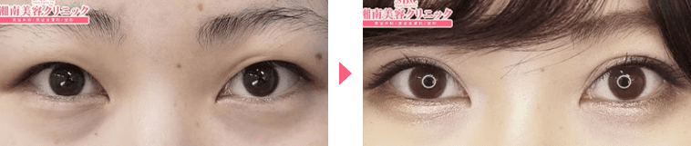 長谷川医師症例写真n266596
