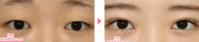 鴨田医師症例写真n216976