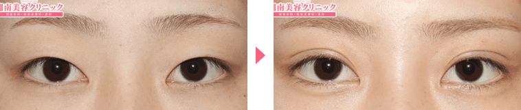 鴨田医師症例写真n285463