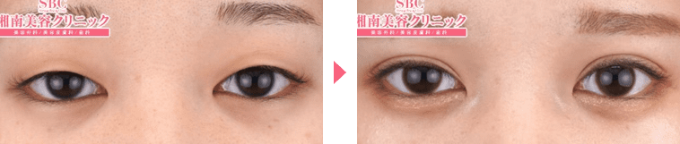 赤尾医師症例写真n271839