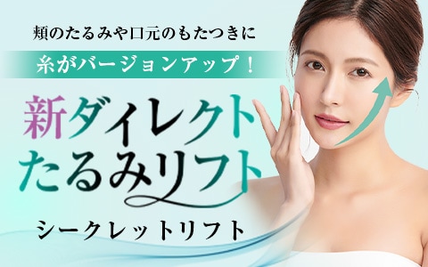 シークレットリフト