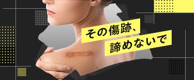 傷跡修正