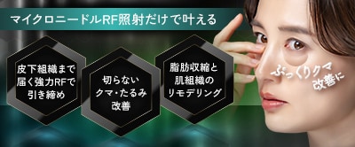 モフィウス８