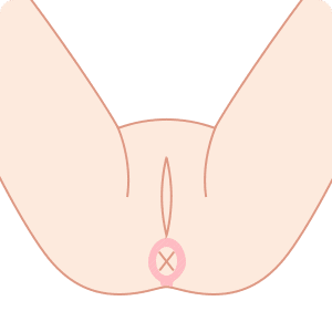 Oライン
