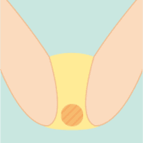 Oライン
