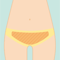 Vライン