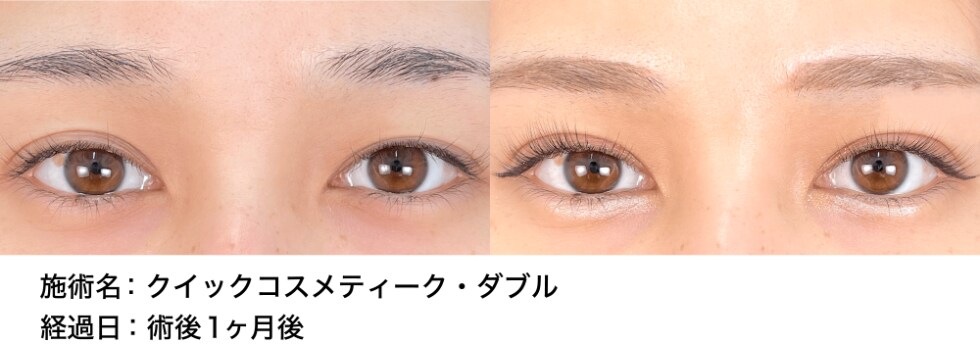 ベスト症例写真