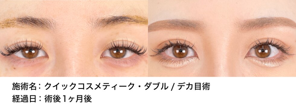 ベスト症例写真