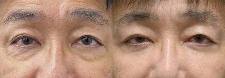 ベスト症例写真