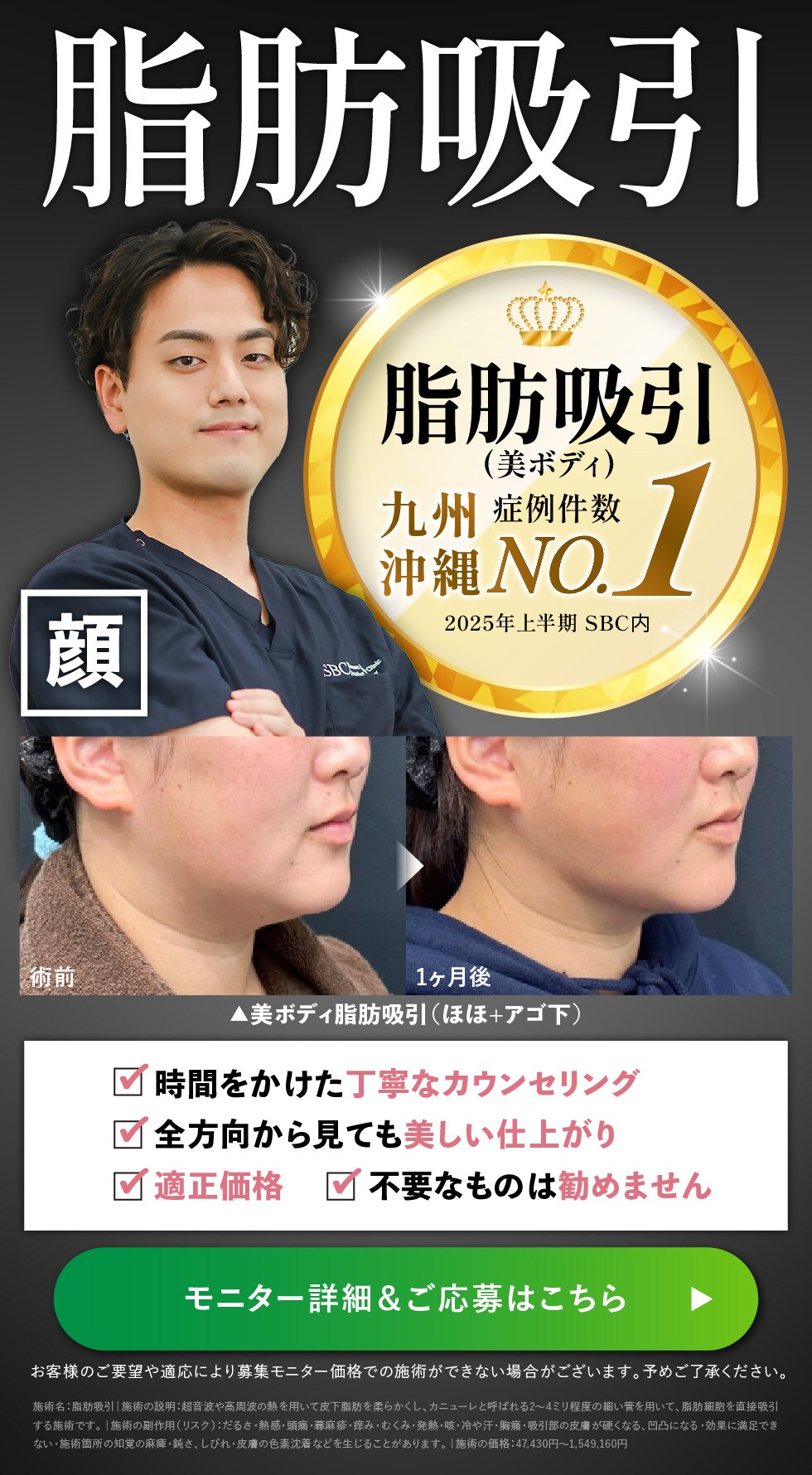脂肪吸引