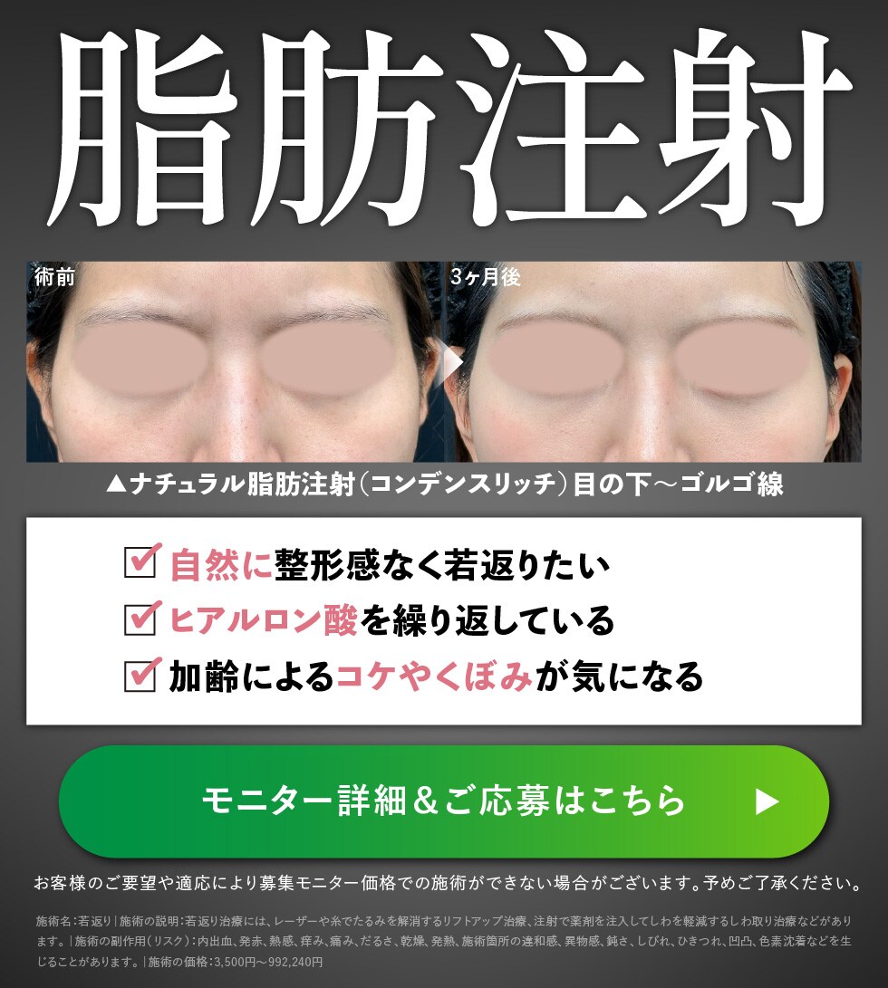 脂肪注射