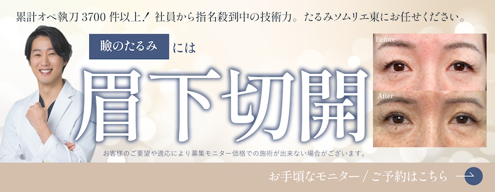 眉下切開