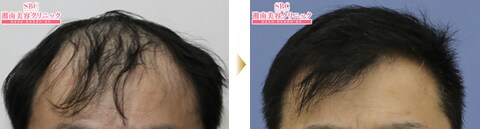 症例写真04