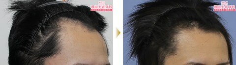 症例写真03