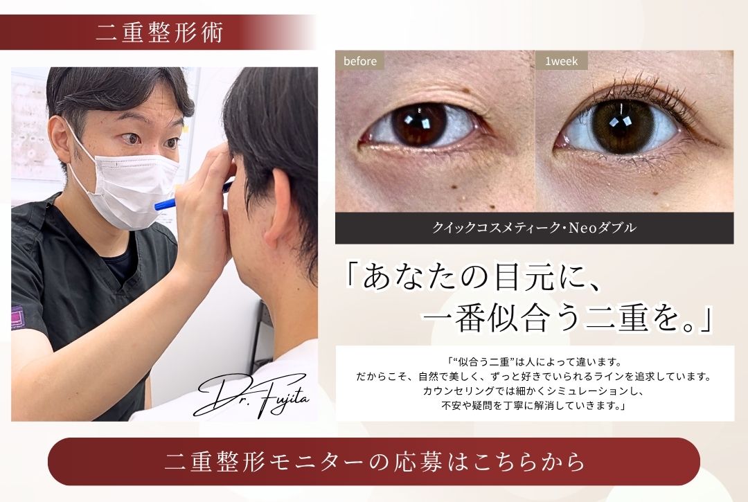 小顔モニター募集