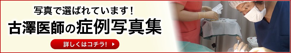 写真で選ばれています!古澤医師の症例写真集