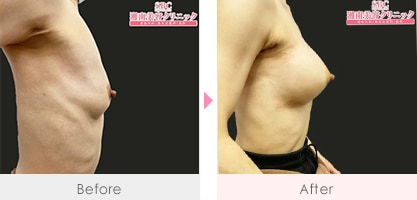 症例写真