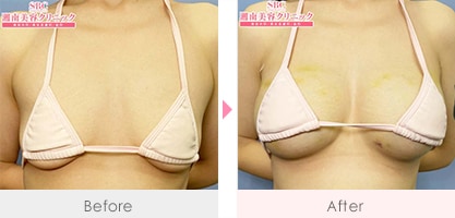 症例写真