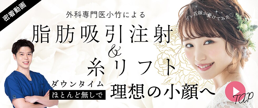 脂肪吸引注射