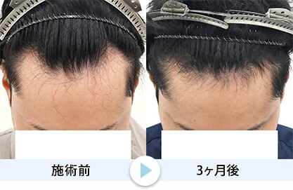 症例写真1