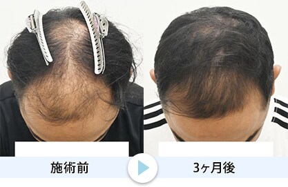 症例写真1