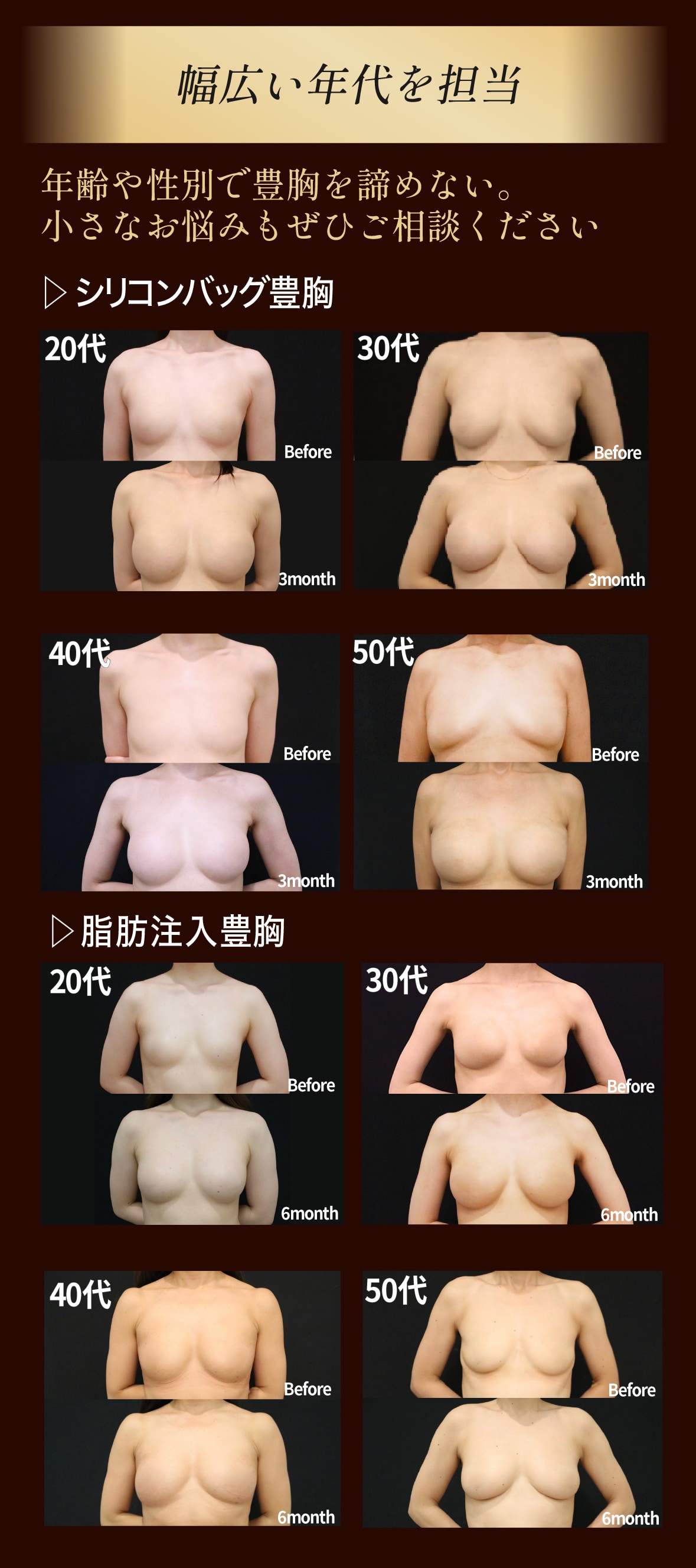 選ばれる理由