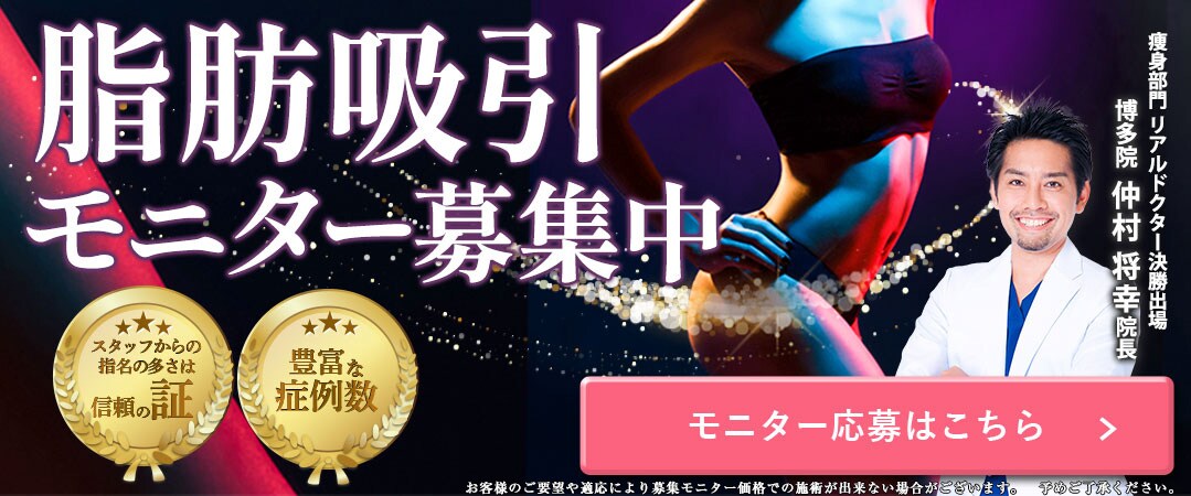 脂肪吸引モニター募集
